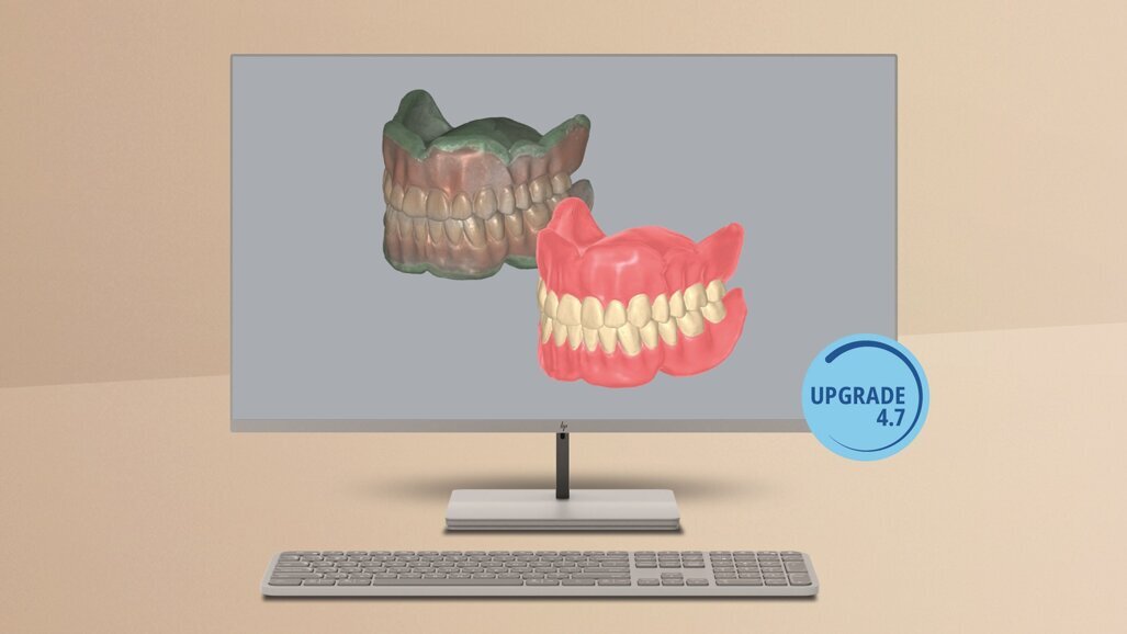 Amann Girbach announces Ceramill update featuring new functions, greater capabilities