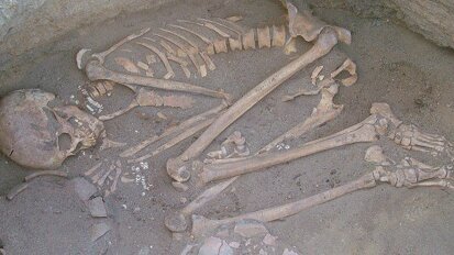 La plaque dentaire pour mieux comprendre le régime alimentaire de nos ancêtres préhistoriques