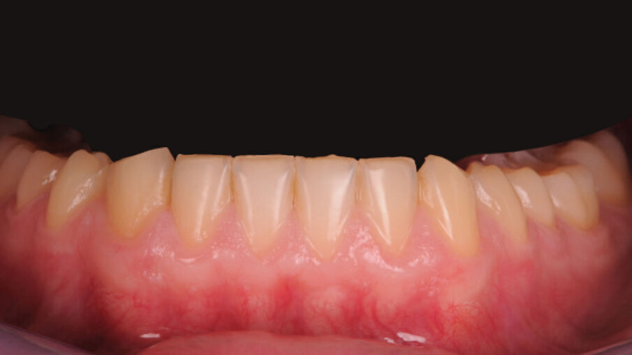 Fig. 4