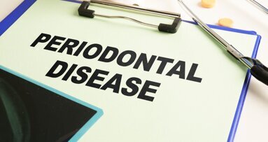 Contour augmentation for periodontal defects (CAPD): A new approach to treating  horizontal periodontal bone loss