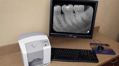 Endodontics made more efficient with the ScanX Swift