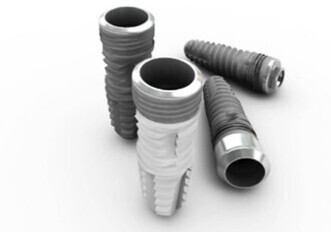 SM Implant System