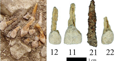 Arqueólogos descubren un implante dental