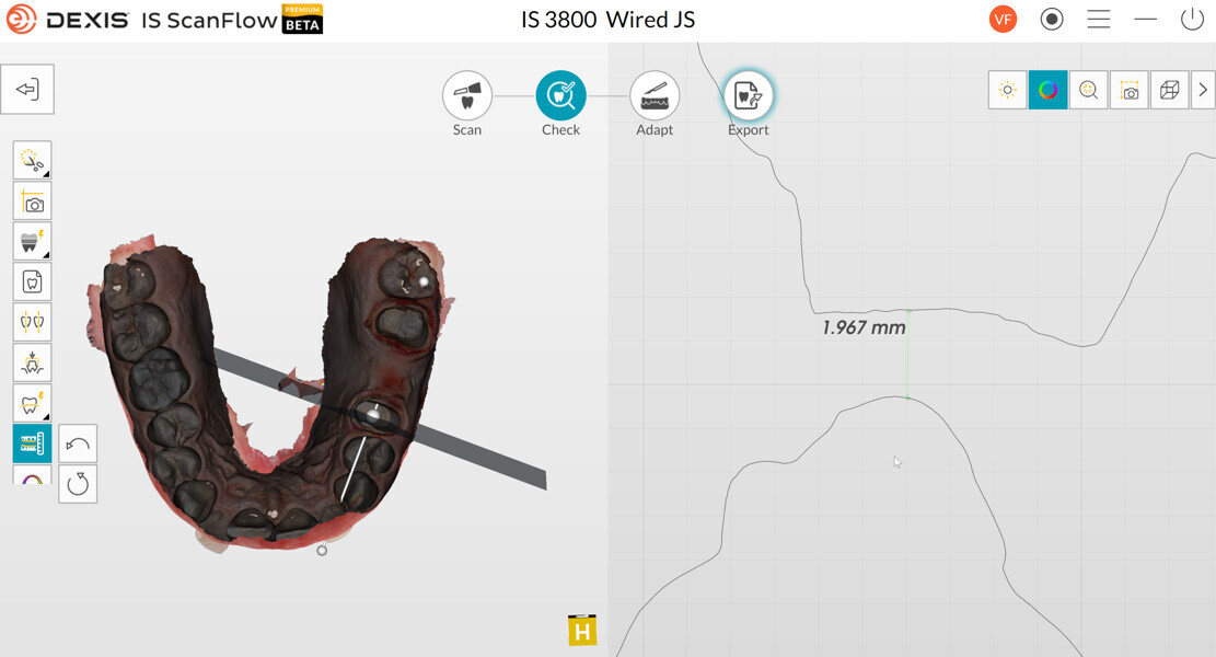 Fig. 3d