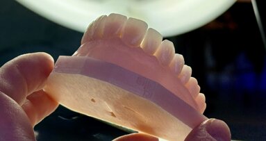 Milling or printing? The reliable path to definitive restorations