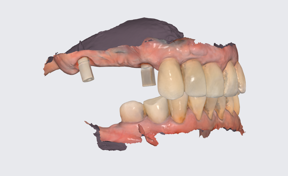 Fig. 18