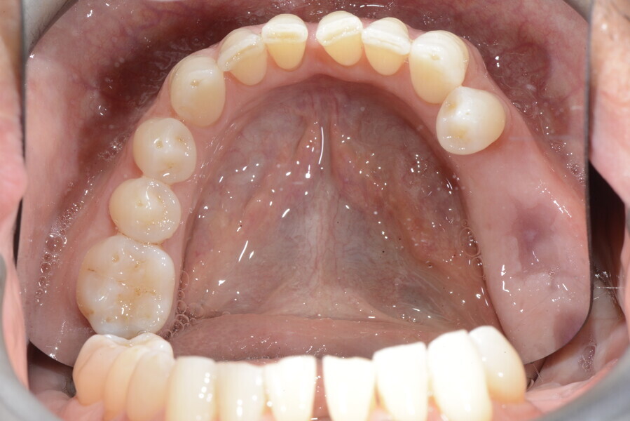 Fig. 17g