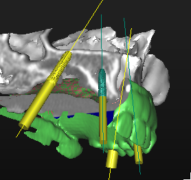 Fig. 16
