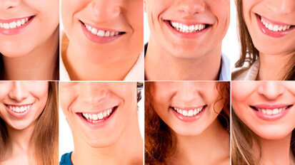 Meglio un sorriso perfetto o “globalizzzato” oppure con qualche difetto ma personale?