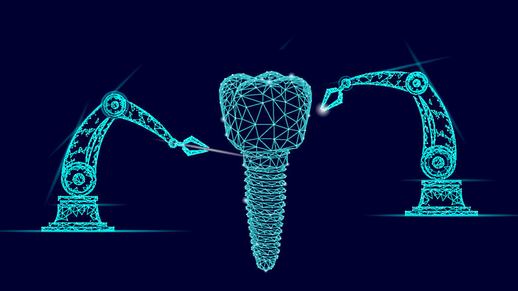 Allisone Technologies now offers dental implant recognition with acquisition of Spotimplant