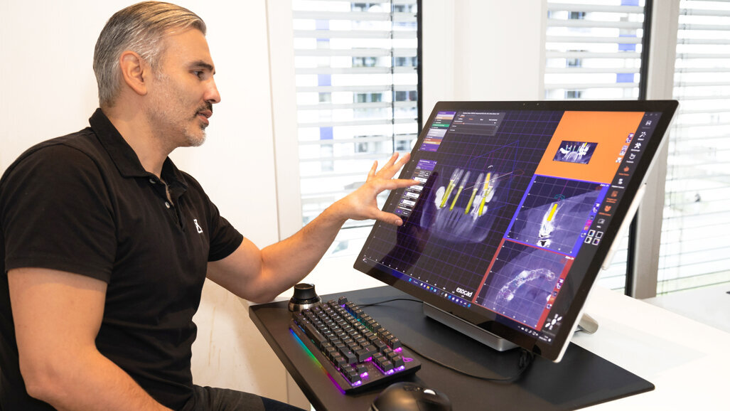 Exocad releases new versions of its chairside and implant CAD software programs