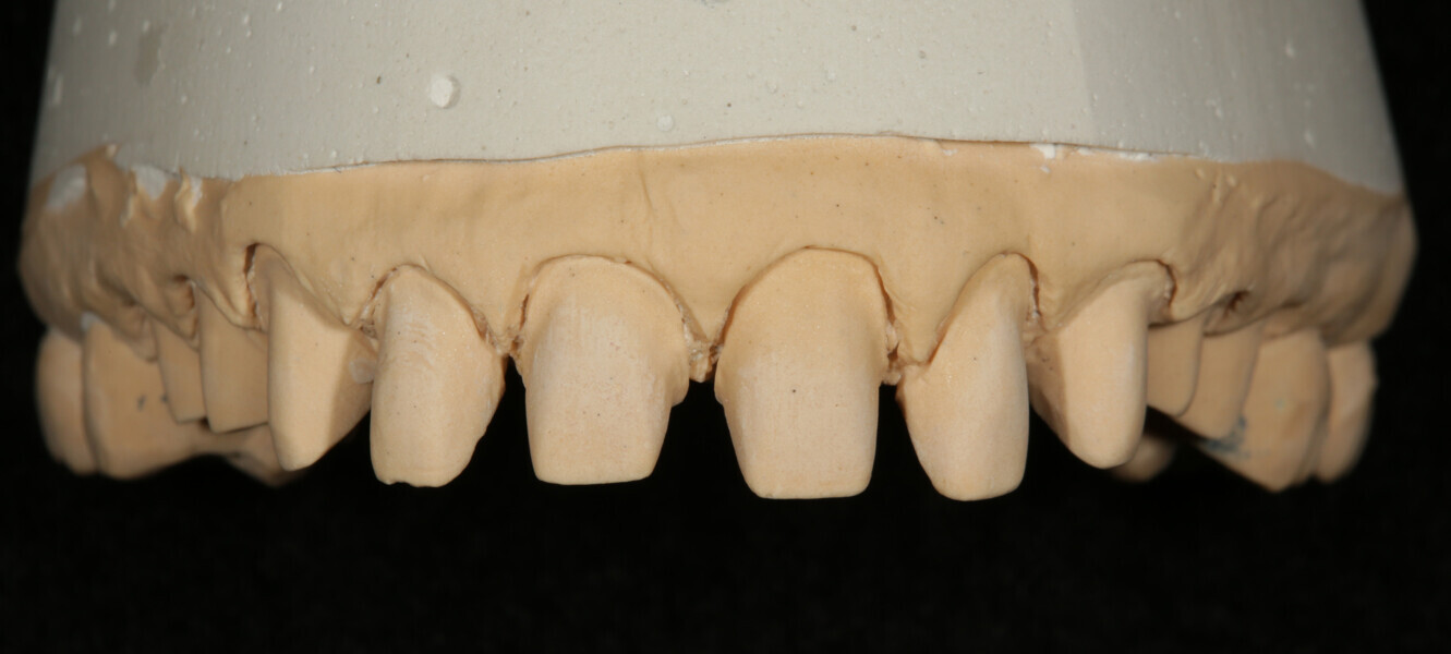 Fig.3