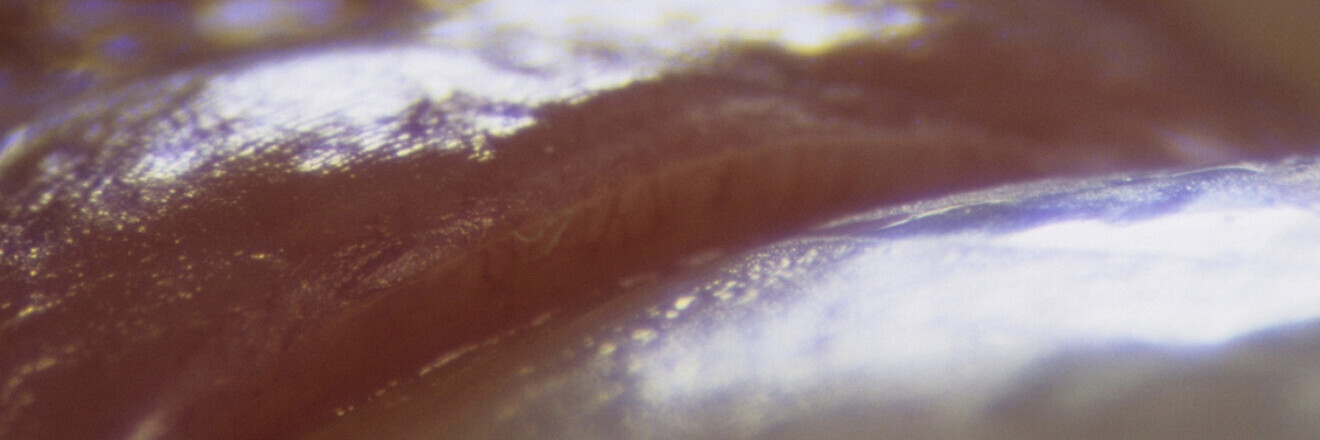 Fig. 25: Marginal precision in the mouth.