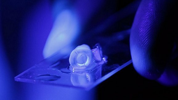 Rivoluzione nel trattamento del canale radicolare grazie ad una nuova ricerca