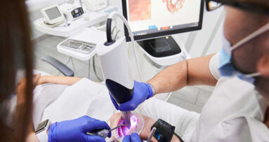 Studija otkrila razlike u preciznosti intraoralnih skenera