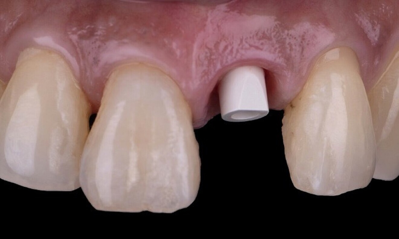 Fig. 11