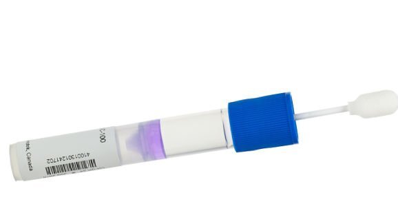 הוצגה בדיקה גנטית חדשה לגילוי סיכון לחלות במחלת חניכיים