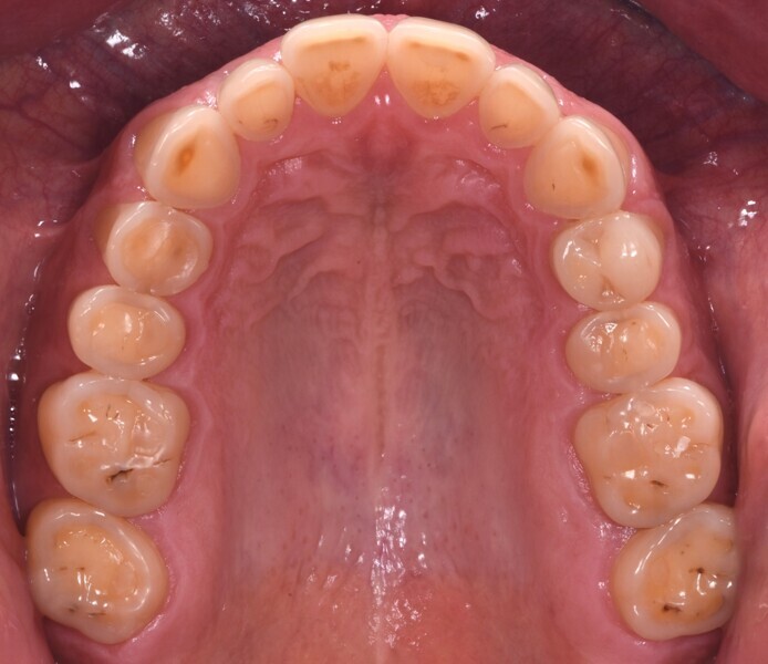 Fig. 2d.