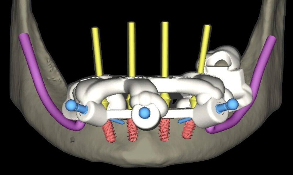 Fig. 43
