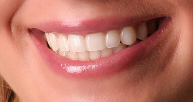 Dental school researchers isolate steps in enamel formation