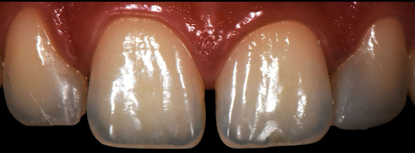 Fig. 2c