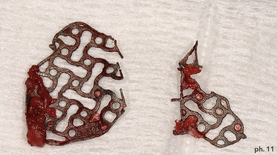 Fig. 11