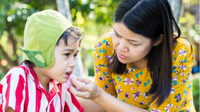 Trẻ nhỏ có nguy cơ cao nhất bị di chứng do trật răng sữa
