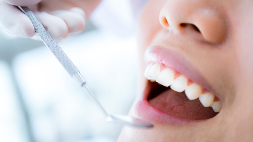Nghiên cứu mới xem xét các yếu tố ảnh hưởng đến sự sẵn lòng tham gia kiểm tra nha khoa