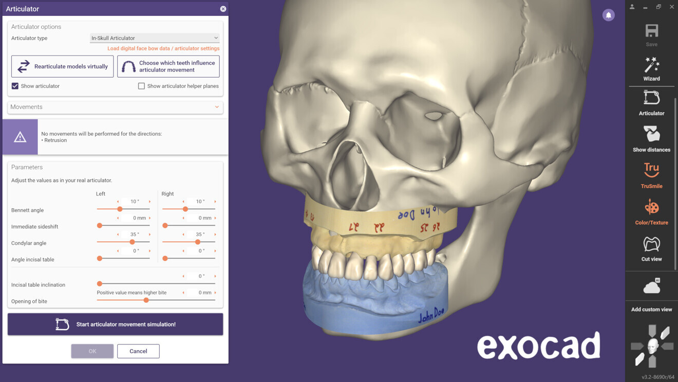 Virtual Articulator includes new support for Gamma Dental Reference SL and Kavo PROTARevo 5B, plus an anatomical “in-skull” articulator visualisation. 