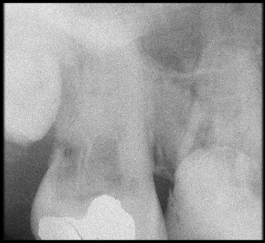 Fig. 10