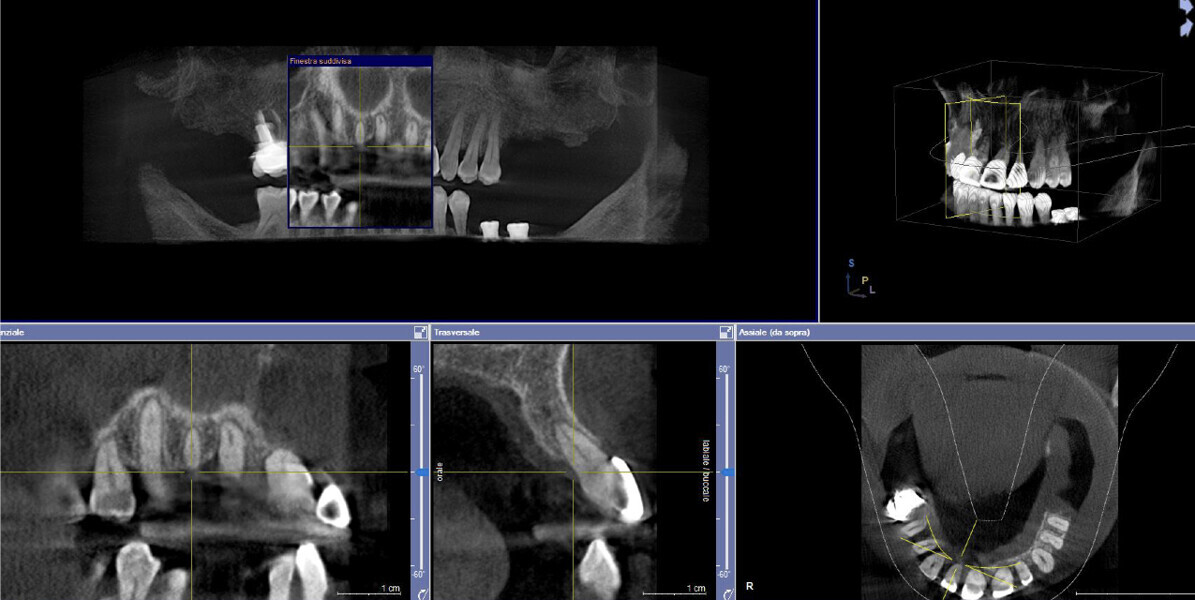 Fig. 22b