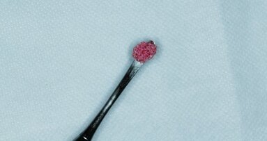 Cellules souches en implantologie
