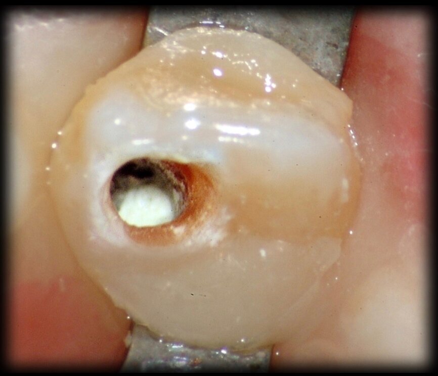 Fig. 35
