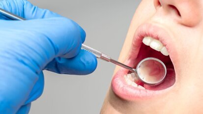 Nghiên cứu cho thấy xét nghiệm nước bọt có thể cách mạng hóa việc theo dõi bệnh nha chu