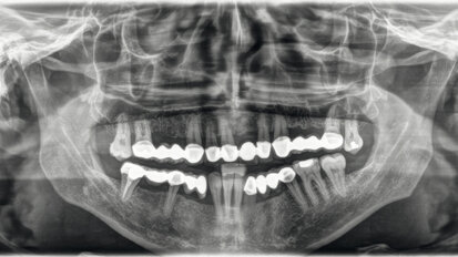 L’odontoiatra può svolgere l’attività radiodiagnostica complementare