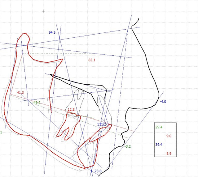 Fig. 4