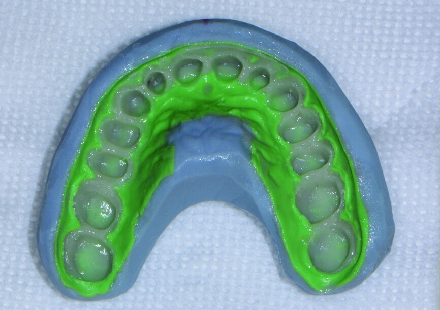 Fig. 6