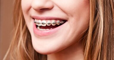 Orthodontisch kwaliteitsregister voor tandartsen