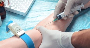 Concentrate Growth Factors (CGF), un preparato dalle varie applicazioni anche odontoiatriche