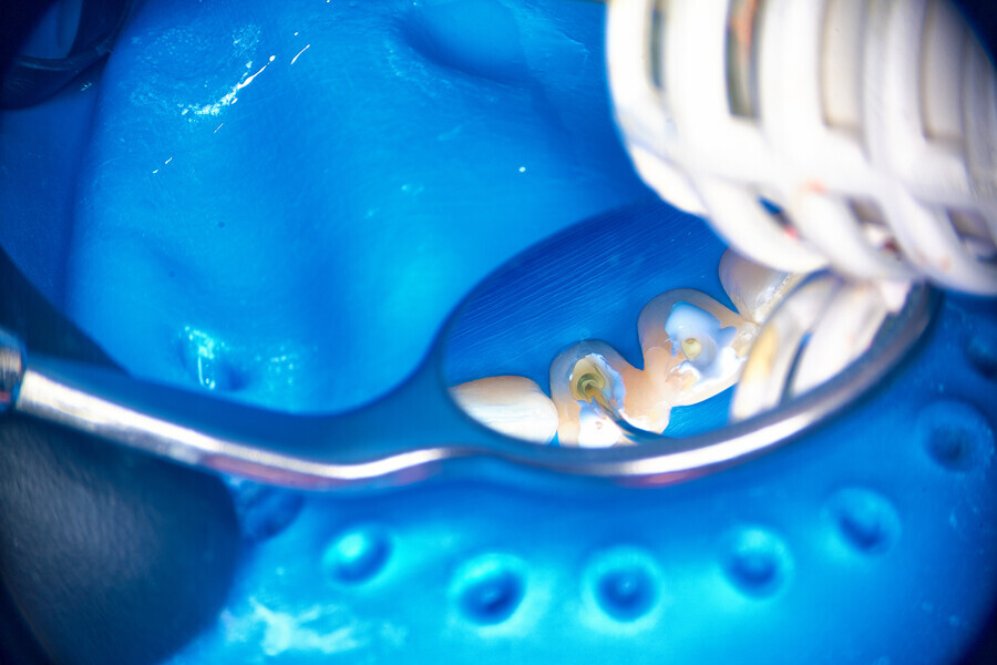Fig. 6d.