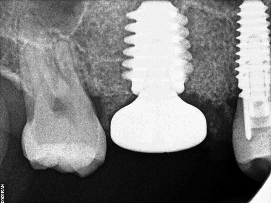 Fig. 10