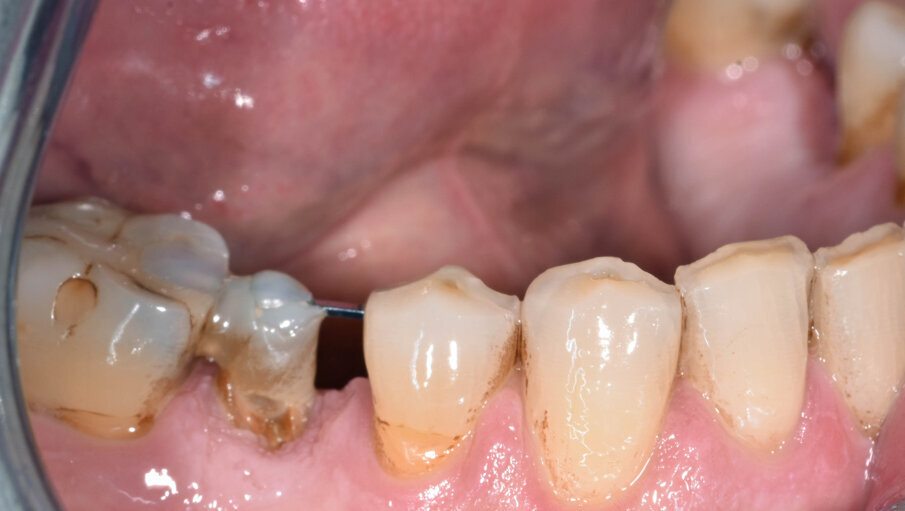 Fig. 10