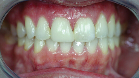 Systems, technology let practices deliver profitable, emergency cosmetic dentistry