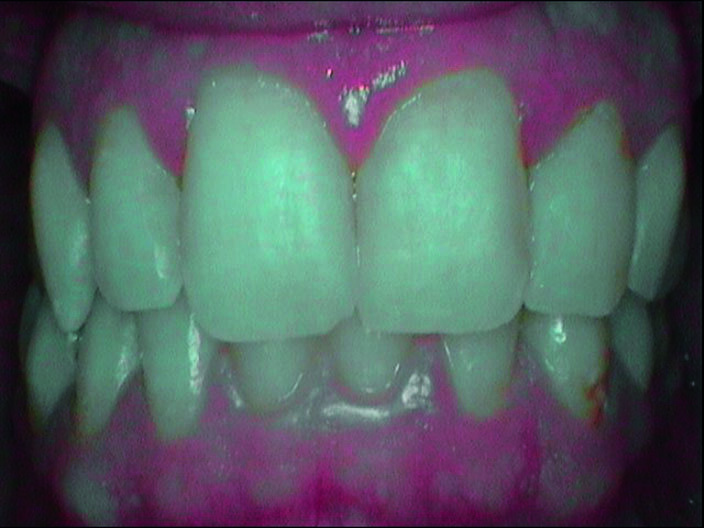 Fig. 2e