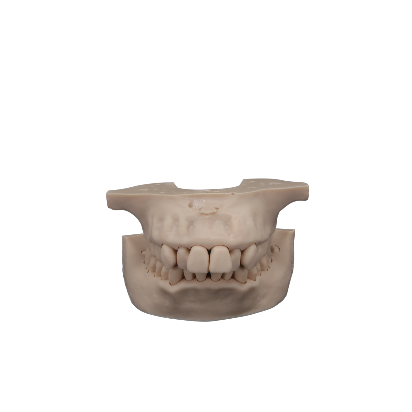 Fig. 15