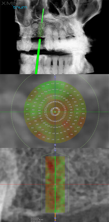 Fig. 14