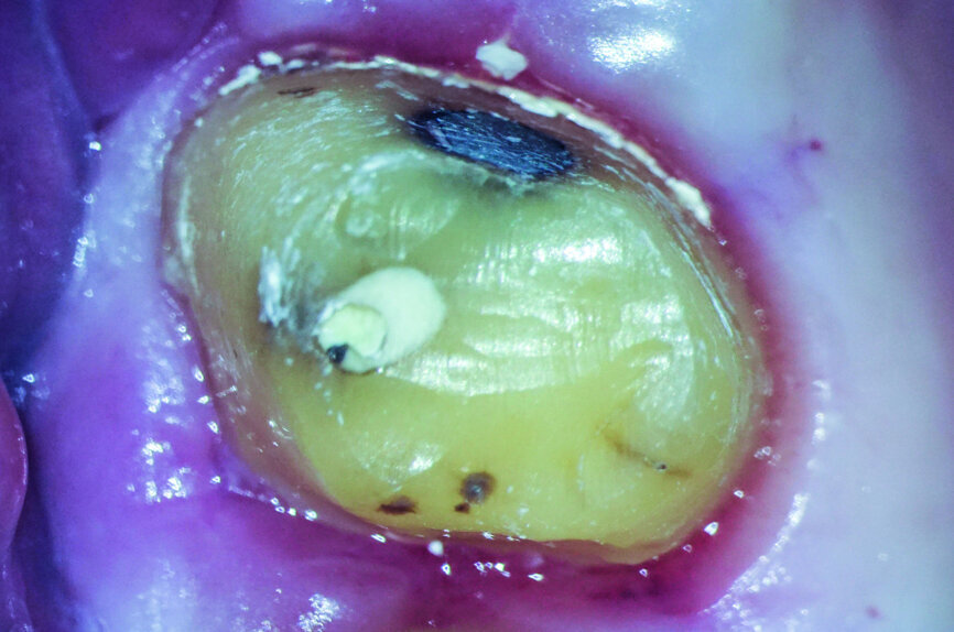 Fig.: 2