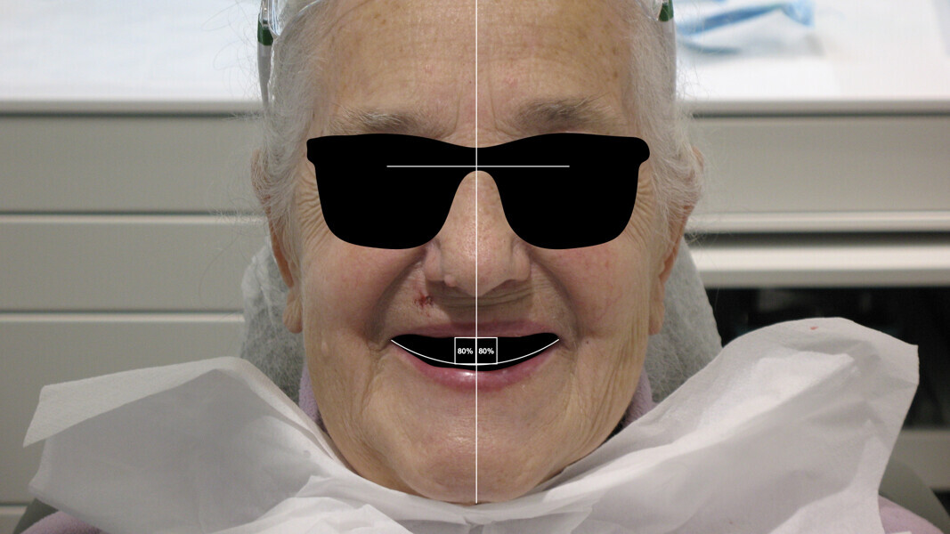 Fig. 3 : Analyse de l’esthétique du visage et du sourire.