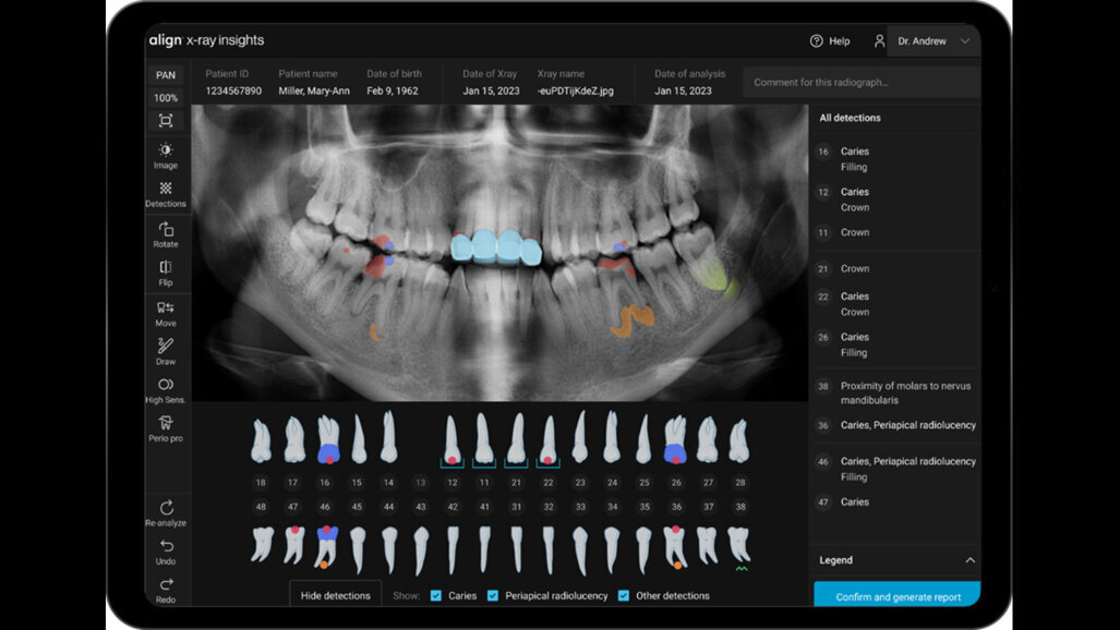 Align Technology introduces new software innovations designed to accelerate digital practice transformation