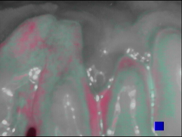 Fig. 2f